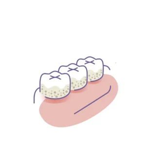 How Often Can You Claim Dental Cleanings Before Your Insurance Drops You?